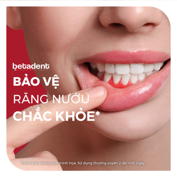Kem đánh răng BETADENT GUMS hỗ trợ các vấn đề nướu lợi 100ml - Ảnh 3