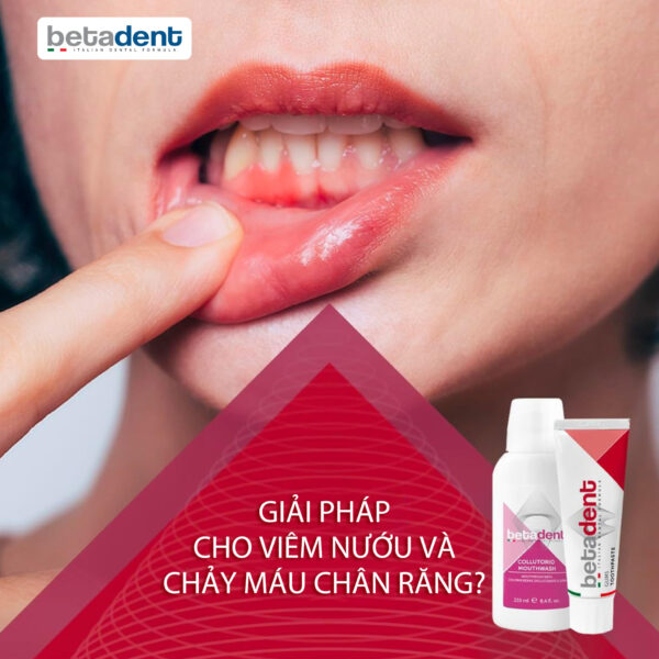 Nước súc miệng BETADENT CHLORHEXIDINE 0.2% hỗ trợ chăm sóc nướu lợi 250ml - Ảnh 5
