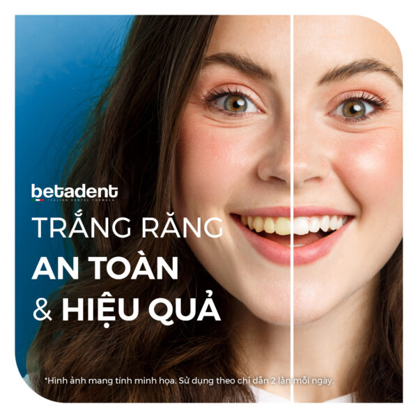 Kem đánh răng BETADENT WHITE hỗ trợ làm trắng răng và hơi thở thơm mát 100ml - Ảnh 7